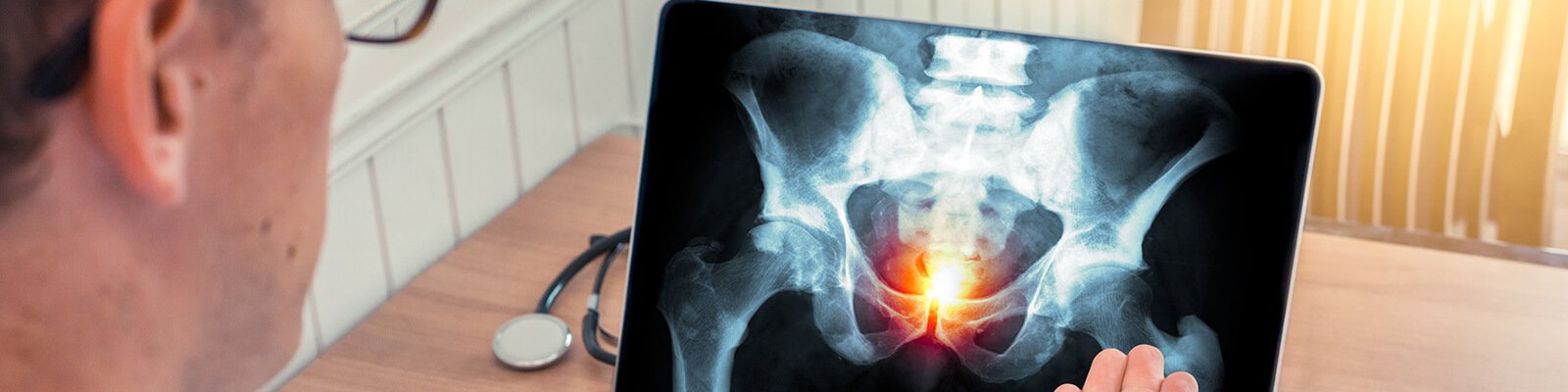 Prostate Gland Function: What Does It Do?