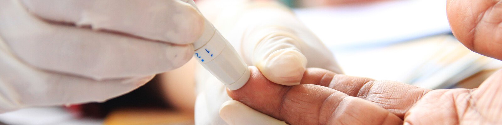 Prediabetes: How To Prevent  Type 2 Diabetes
