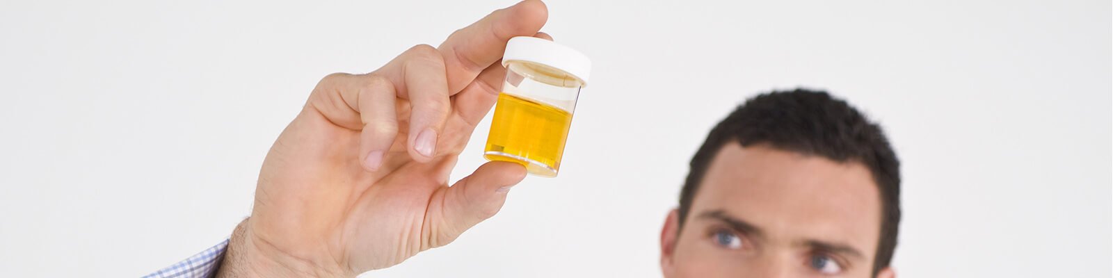 Urinary Tract Infections (UTIs) in Men