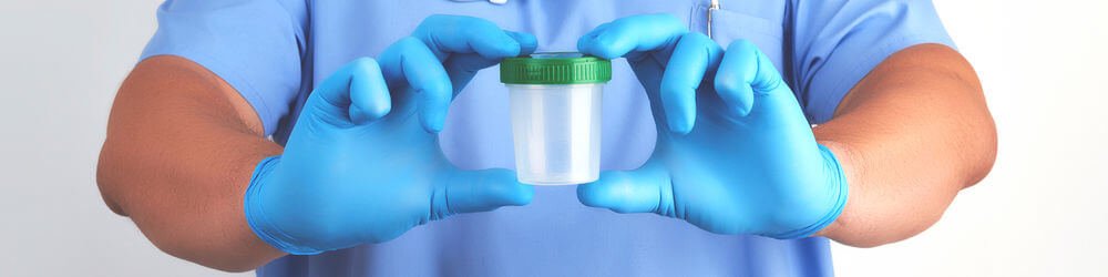 PCA3 Test and Prostate Cancer