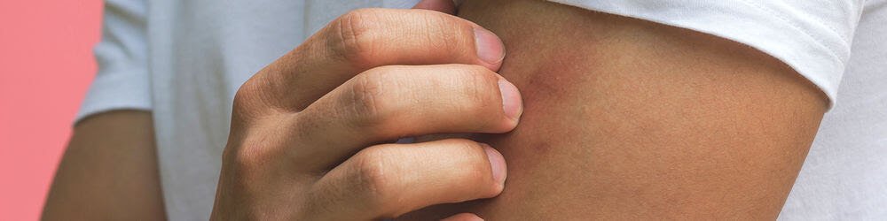 The Effects of Diabetes on Skin