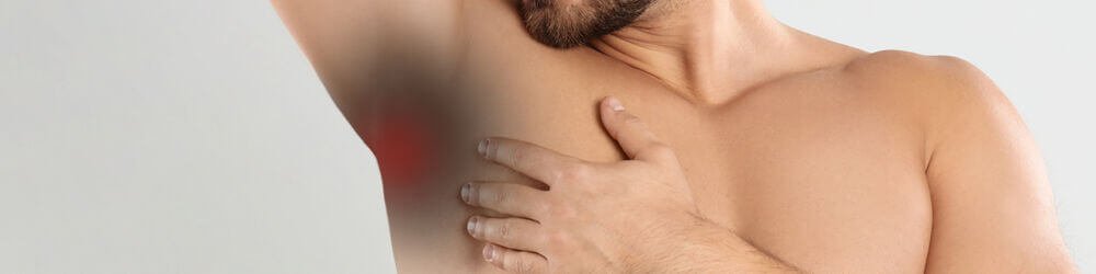 Acanthosis nigricans: Symptoms and Causes