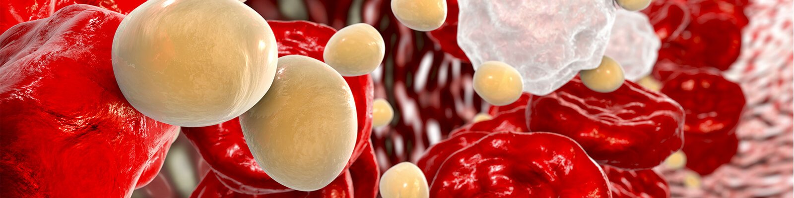 Atherosclerosis – Causes, Symptoms, & Treatment