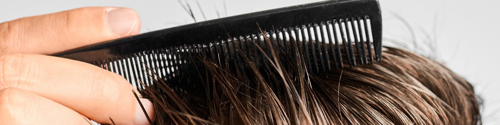Does Diabetes Cause Hair Loss?