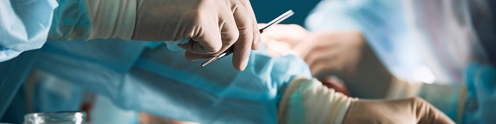 Male Sling Procedure: What You Should Know
