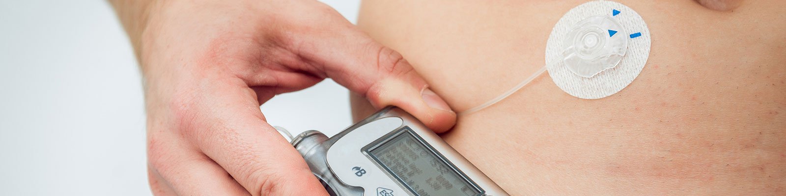Diabetes Patches: Types, What They Are and Do They Work?