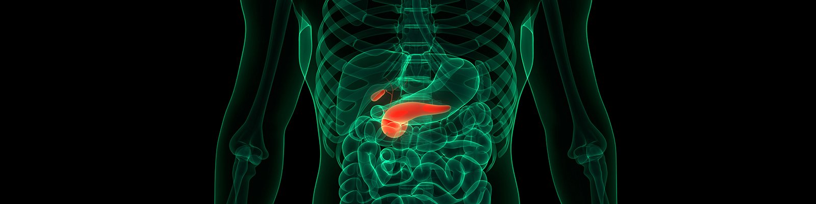 Islet Transplant for Type 1 Diabetes: What You Should Know