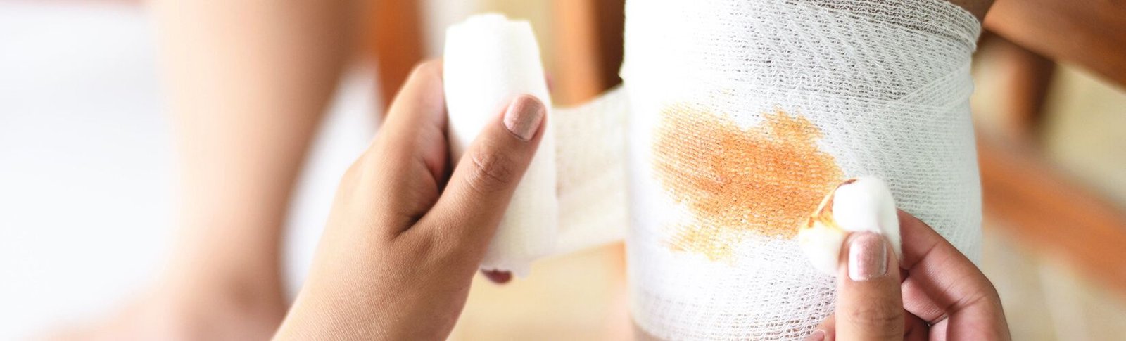 Diabetes and Wound Healing: Why Is It Slower?