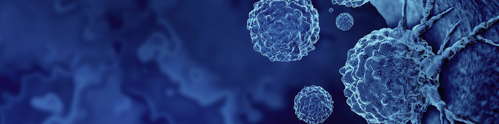 Focal Therapies For Prostate Cancer