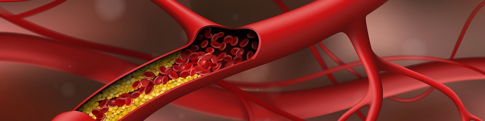 10 Natural Cholesterol Lowering Remedies Supported by Science