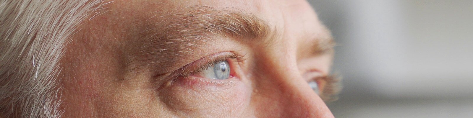 Watery Eyes: Causes, When to See a Doctor & Treatment