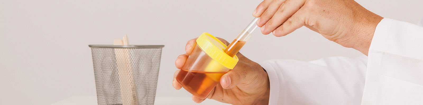 Doctor Answers: What Are Causes Of Weak Urine Stream?