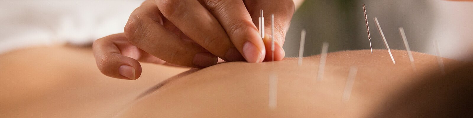 7 Reasons Men Should Do Acupuncture