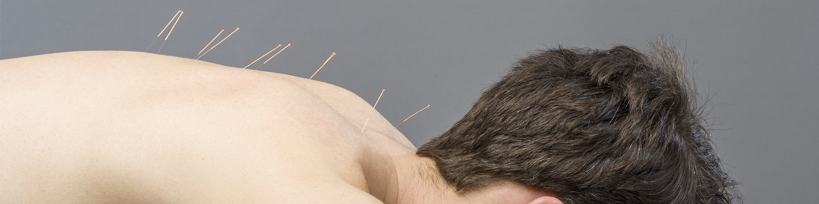 Doctor Answers: What is Acupuncture for Prostate Inflammation?