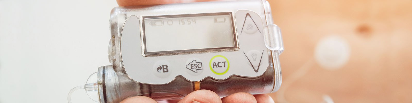 Wearable Tech in Diabetes Care: New Devices That Have Made an Impact