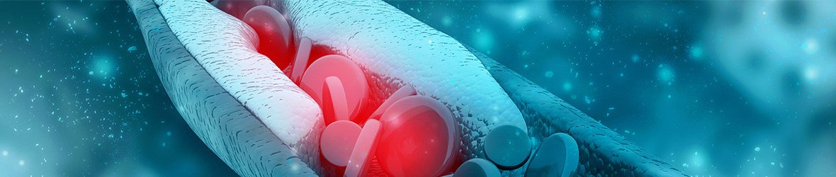 Cholesterol and Cancer: What’s the Link?