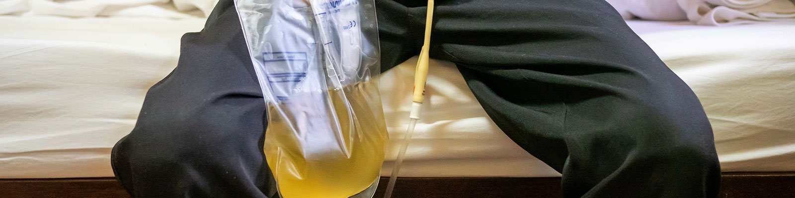 How To Reduce Unnecessary Urinary Catheter Use
