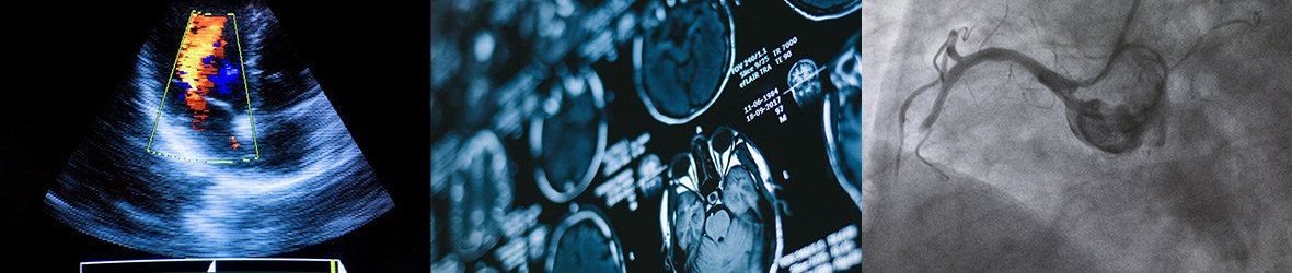 Types Of Medical Imaging Scans and X-rays You Need to Know About