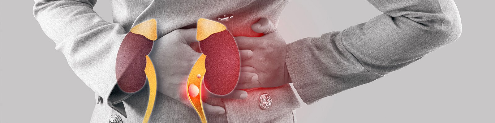 Signs And Symptoms Of Kidney Stones
