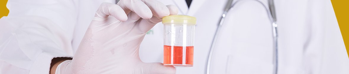 Blood in Urine (Hematuria) Explained