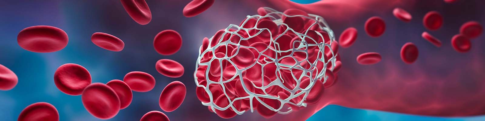 6 Ways to Prevent Blood Clots