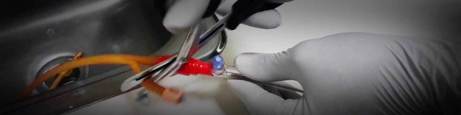 Doctor Answers: What tips are there to Urinate After Catheter Removal?