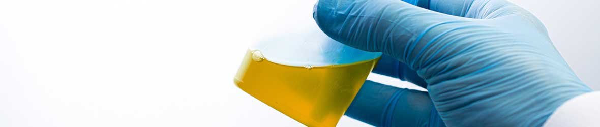 Doctor Answers: What Causes Mucus in Urine?