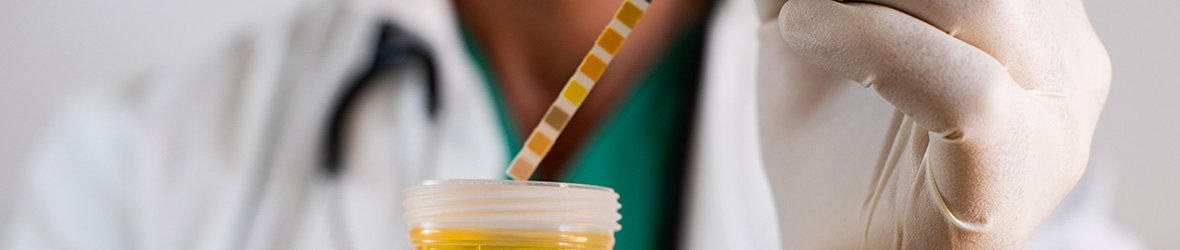 Protein In Urine (Proteinuria): Causes & Treatment