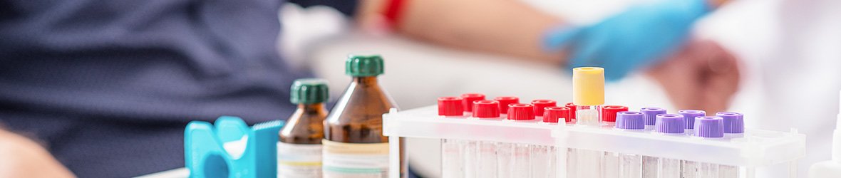 New Prostate Cancer Blood Test With 94% Accuracy