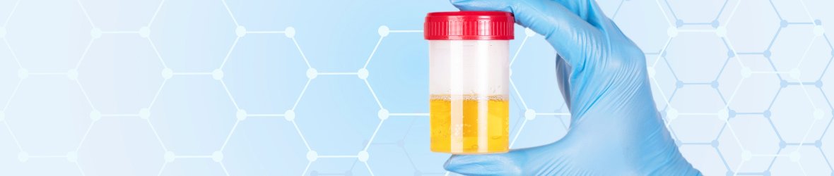 Doctor Answers: Why Do I See White Particles in Urine?