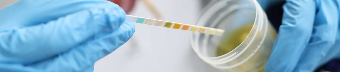 Bladder Infection vs UTI: What’s the Difference?