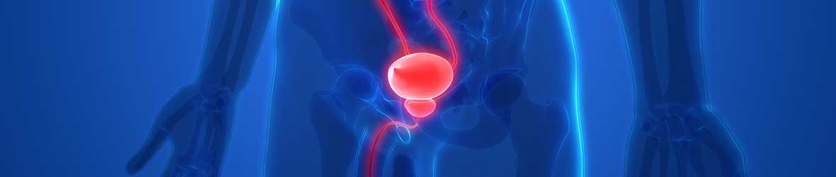Neurogenic Bladder: Signs, Causes, Treatment