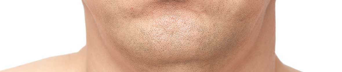 What to Know About Ozempic Face & How To Fix It