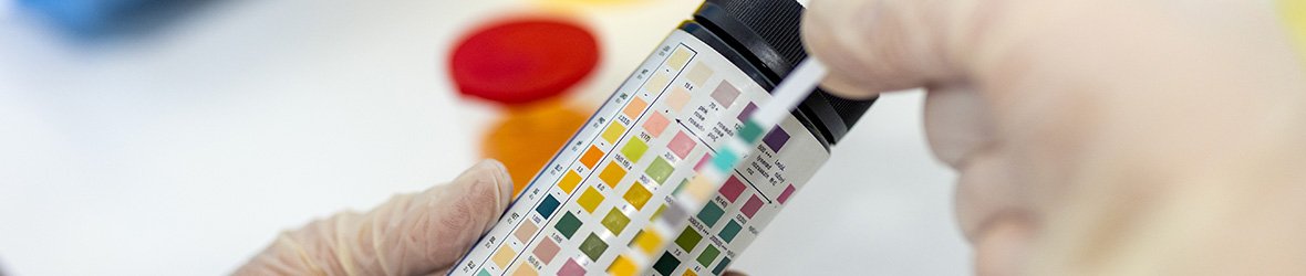 Doctor Answers: Why Do I Have Nitrite in Urine?