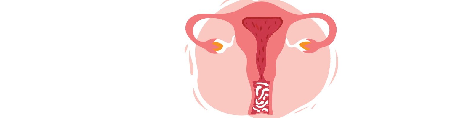 How To Prevent Yeast Infections When Taking Jardiance (Empagliflozin)