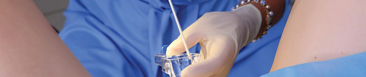 4 Things That Can Cause An Abnormal Pap Smear Besides Cancer