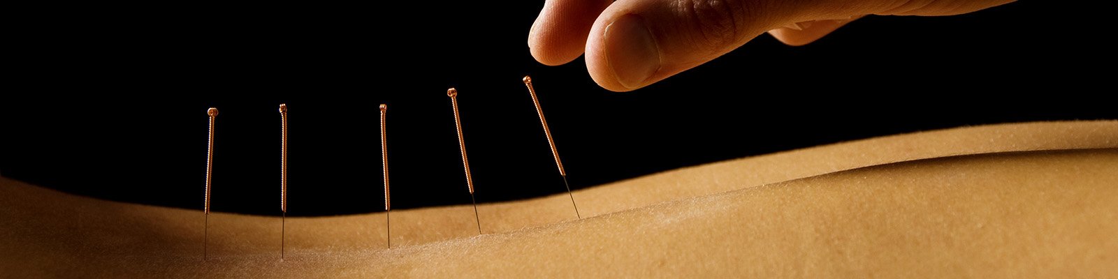 Acupuncture For Diabetes: Can Acupressure Help Neuropathy?